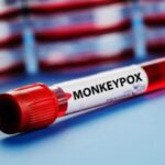 How Does Monkeypox Spread? Facts
